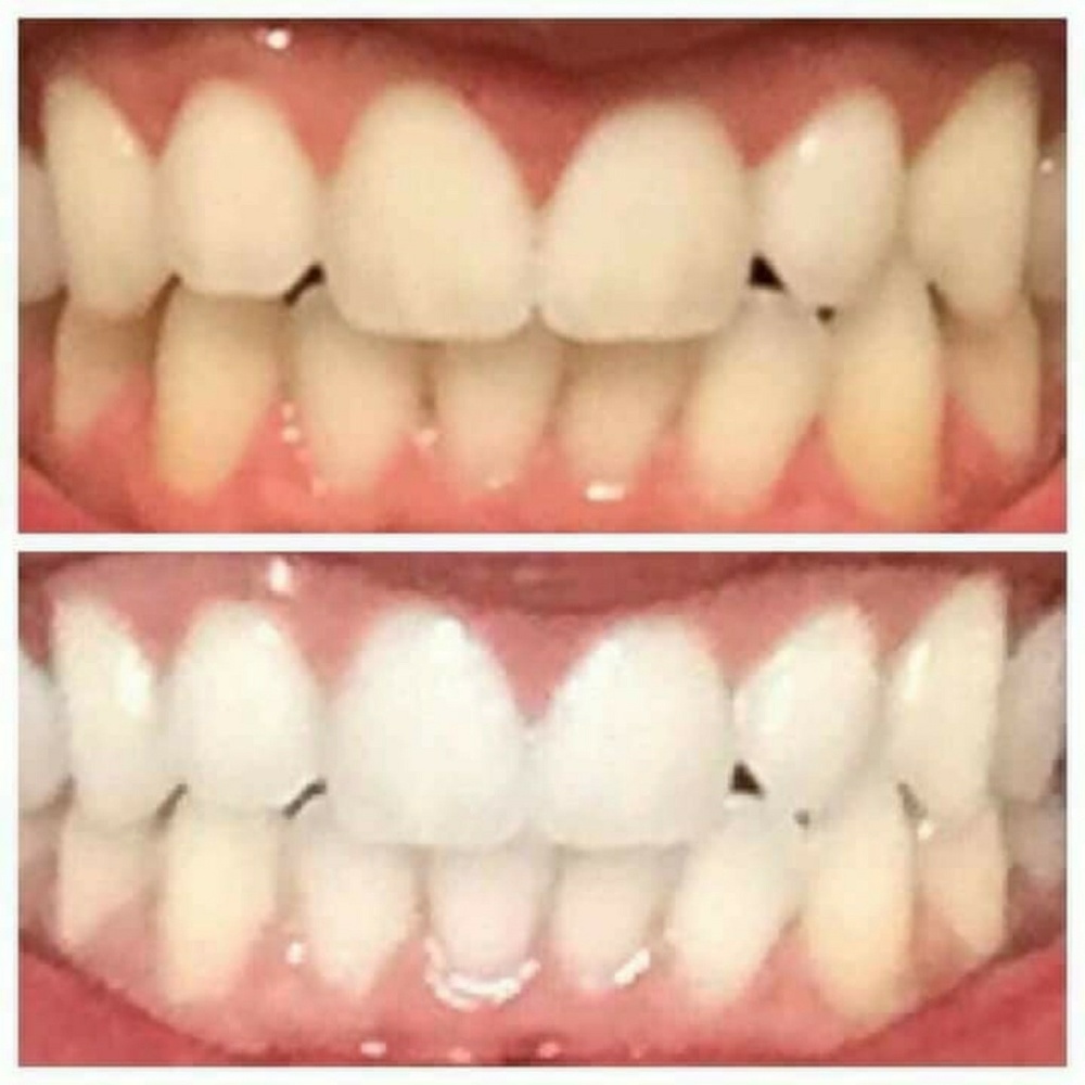 Toothpaste